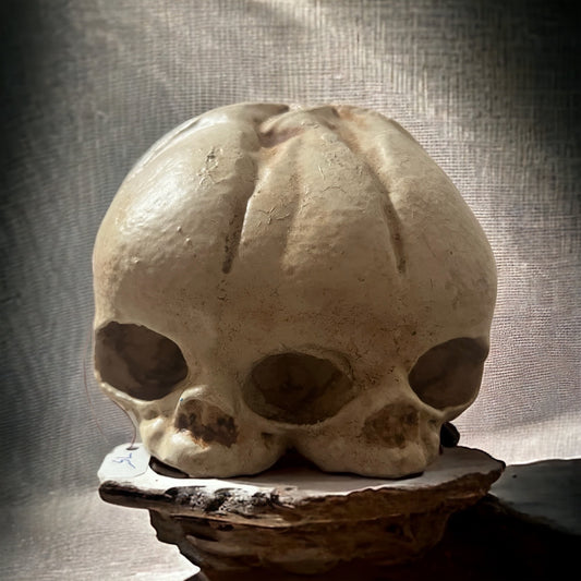 Diprosopus Conjoined Twin Fetal Skull (3D Printed Replica)